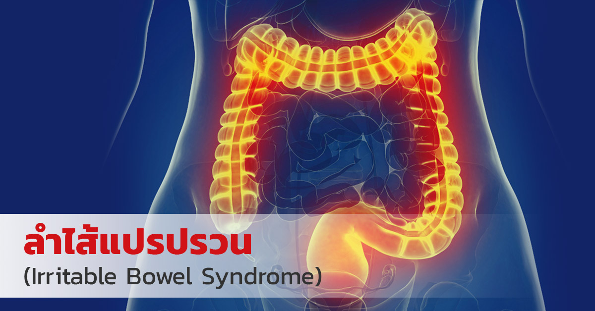 ลำไส้แปรปรวน (Irritable Bowel Syndrome)