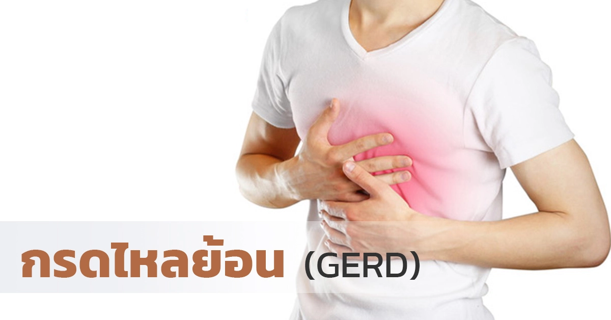กรดไหลย้อน อาการแสบร้อนบริเวณกลางหน้าอก GERD